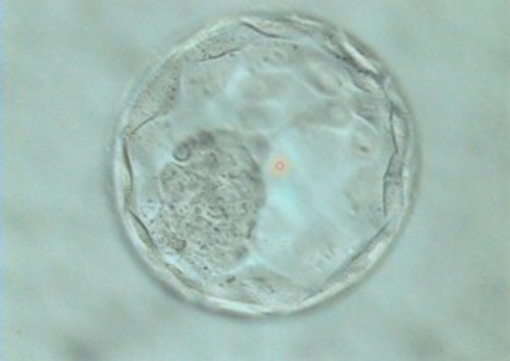 Human Embryo at 5 days (a.k.a. blastocyte)